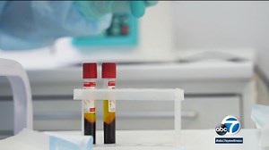 Coronavirus pandemic: Red Cross' free COVID antibody testing provides incentive to donate blood