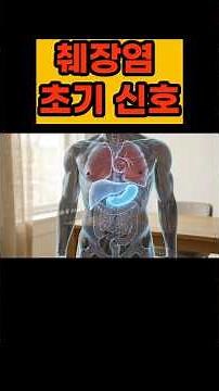 Early Signs of Pancreatitis 🚨 Beware of Epigastric Pain and Irritating Foods
