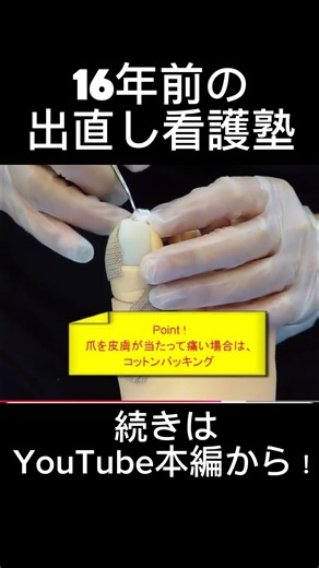 【巻き爪の切り方】16年前の出直し看護塾#看護師#助産師#保健師#特定看護師#出直し看護塾