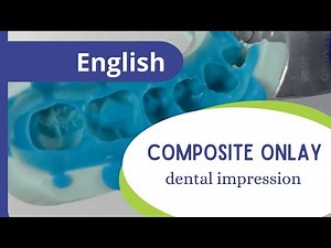 Composite onlay - part 2: dental impression.