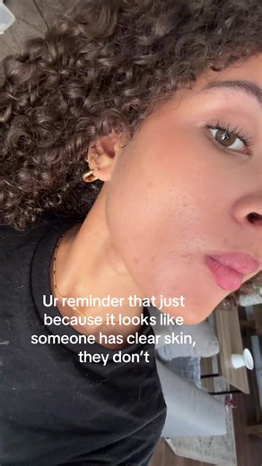 I’ve been trying to make my makeup not look “cakey” but I realized it’s just skin and u can’t photoshop yourself irl #realskintexture #makeupwithtexture #acne #selflove #sardinemomma