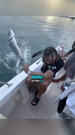 Did he lose his finger?😳