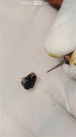 earrings clogged with gunk! #piercing #earings #gonewrong #earpiercing