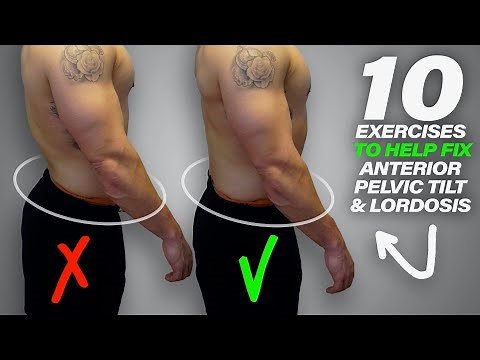 10 Exercises to Help Fix Anterior Pelvic Tilt & Lordosis