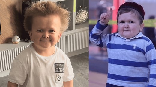 Who is Hasbulla? Real age, UFC contract and his condition explained