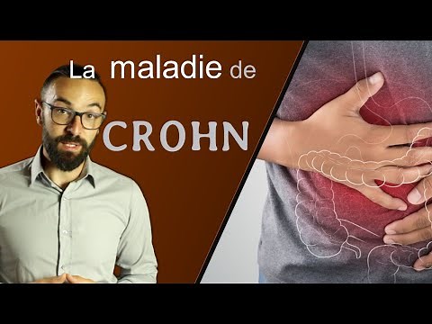 🩺 Tout savoir sur la maladie de CROHN