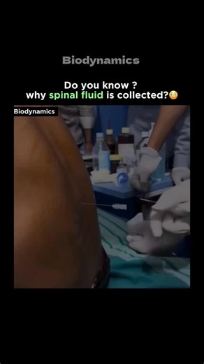 Medical | Science | Facts on Instagram: "Cerebrospinal Fluid (CSF) Collection CSF is a clear, colorless fluid that surrounds and protects your brain and spinal cord. It acts as a cushion, nutrient carrier, and waste remover for your central nervous system. The procedure to collect it is called a Lumbar Puncture (Spinal Tap) - where a needle is carefully inserted into the lower back to draw a small amount of fluid. This test helps doctors diagnose: Infections (like meningitis) Brain bleeding (sub