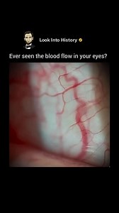 12K views · 72 reactions |  The human body is wild this is how blood flows inside your eyes. Science is insane when you see it this close! ✨ Video: @doktorite - #sciencefacts #humanbody #eyefacts #biology #didyouknow #wowfacts #learnsomethingnew | How History Is Created | Facebook