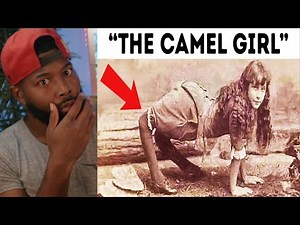 someone was clapping camel girl cheeks | 7 People U Won't Believe Exist Till You See Them | REACTION
