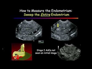Classic Lectures in Clinical Ultrasound: What You Need To Know - A Video CME Teaching Activity