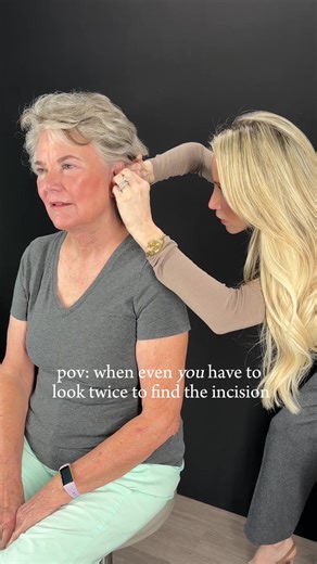 “Where are my incisions?” One of my favorite questions. I place them along Langer’s lines and natural folds to minimize tension, and long term visibility. What do you want to know about incision placement?