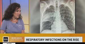California health officials say respiratory infections are on the rise