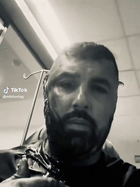 Sam Walker's Head Injury: True Crime Insights