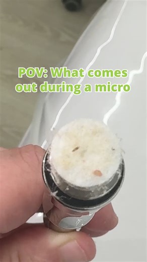 1.1K views | Microdermabrasion is the ultimate exfoliation technique, revealing smoother, more radiant skin by removing dead skin, excess oil, and debris. Check out the results of our Micro Express treatment!Complimentary consultations available with our Skin Therapists. Link in bio. #Microdermabrasion #resultslaserclinic #closeup | Results Laser Clinic | Facebook