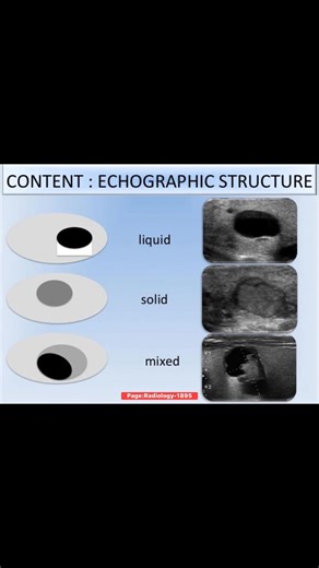 Understanding Echographic Structures in Ultrasound Imaging