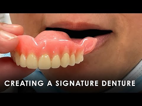 Creating a Signature Denture