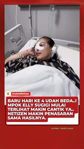 PROSES OP HIDUNG MPOK ELLY SUGIGI YANG KE 4 HARI, HASILNYA BIKIN NETIZEN PENASARAN #viral
