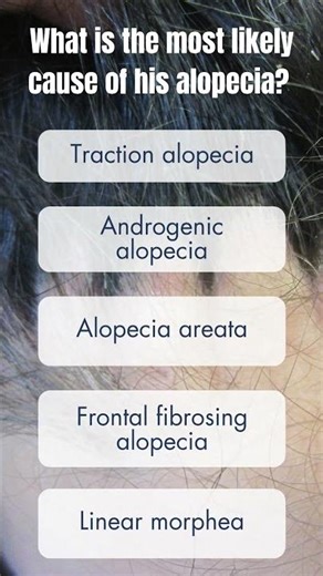 Pediatric Skin-Sights Case of the Week #pediatrics #cases #dermatology #medicaleducation