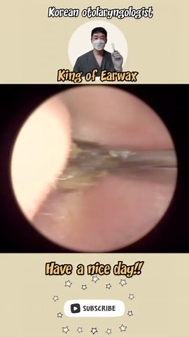 Effective Earwax Removal Techniques