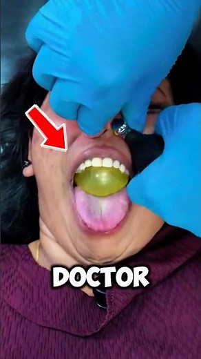 🤯 Balloon Up Your Nose? The Ultimate Medical Trick Exposed! 💨