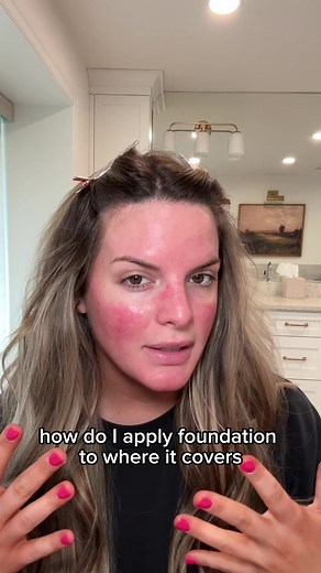 Best Makeup Tips to Cover Redness - Rosacea Tutorial