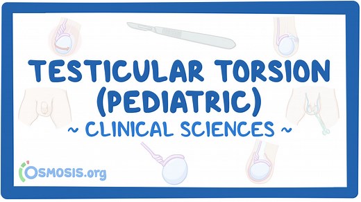 Testicular torsion (pediatrics): Video & Meaning | Osmosis