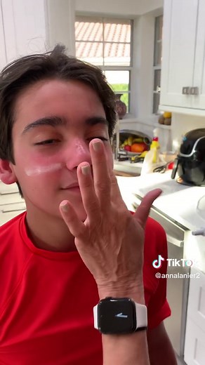 Heal Sunburn Overnight with Neosporin | Safe Remedy for Kids