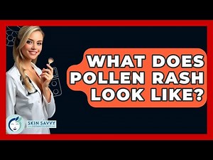 What Does Pollen Rash Look Like? - Skin Savvy Dermatology
