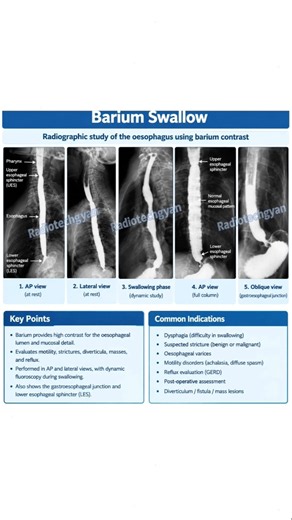 Barium Swallow X-Ray | Esophagus Study Explained 🩻 | Radiology