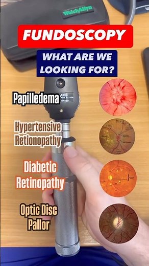 CHIROPRACTORS EXAMINE EYES 👀⁉️#chiropractic #retinopathy #ms #eyehealth #fyp