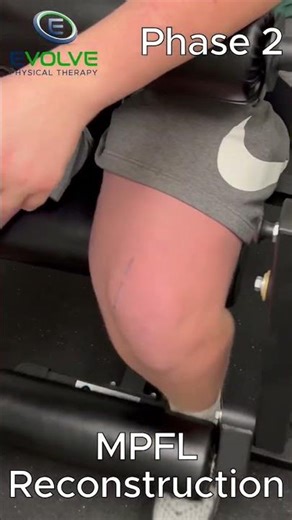 ⚡️ MPFL Rehab Phase 2: Ultimate Quad Strengthening!