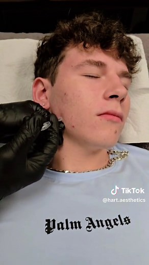 Effective Botox Solution for Teeth Grinding Relief