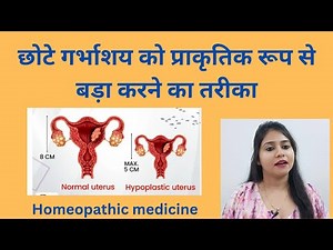 Small uterus treatment !! Hypoplastic uterus symptoms,causes & homeopathic medicines !!