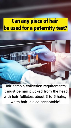 Paternity Test: Can Any Hair be Used?
