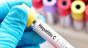 Síntomas de la hepatitis y sus tipos; así se puede contagiar