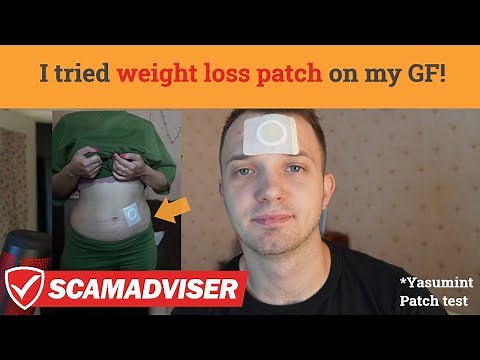 Fujimint Slimming Patch Review and test! Is it scam? Does it help for weight loss? *BEFORE AND AFTER
