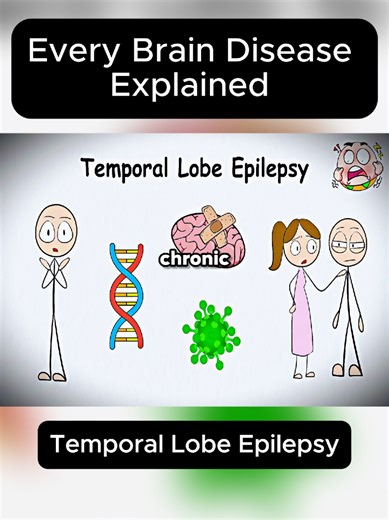 Every Brain Disease Explained #explained #explain #viral #fyp
