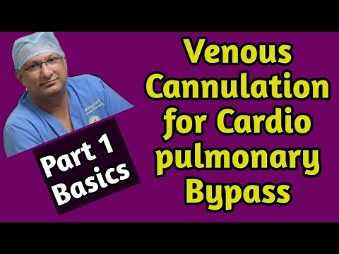 Basics of Venous Cannulation for Cardio Pulmonary Bypass: Part 1