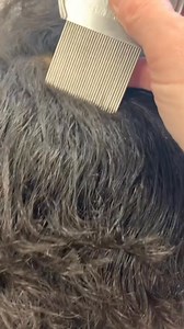 #lice #piojos #poux #piolhos #asmr | Lusiana