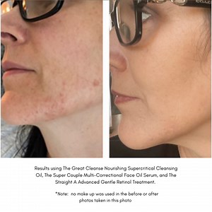 The Great Cleanse - Nourishing Supercritical Cleansing Oil