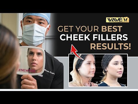 Adding Mid-Face Volume : How to get the BEST Results from your Cheek Filler Consultation