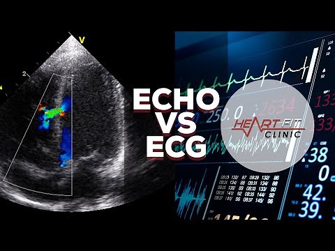 Echocardiogram vs Electrocardiogram