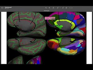 Cortical Surface Cutting and Flatmap Generation using FreeSurfer tksurfer
