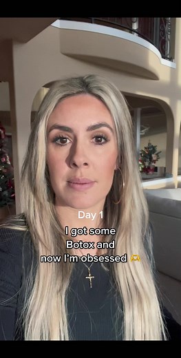 Botox Injection Results | Before & After Transformation