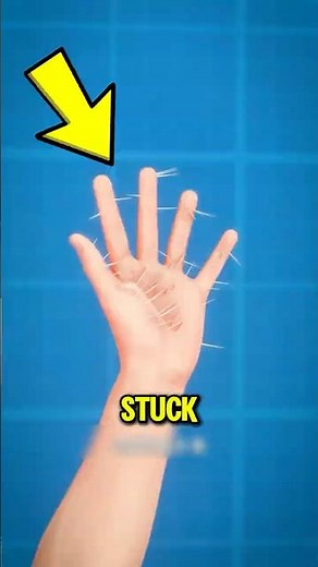 Never Pull Out a Splinter Before Watching This! 😱