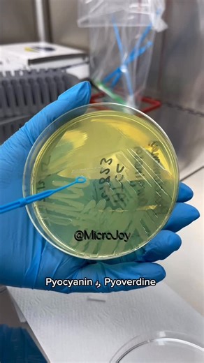Micro_Joy on Instagram: "Pseudomonas spp. 🦠And biochemical tests 🧪🧪#lablife #lab #microbiology #microjoy #bacteria"