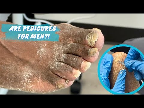 SATISFYING MEDICAL PEDICURE + HEEL RESTORATION [PART 1]