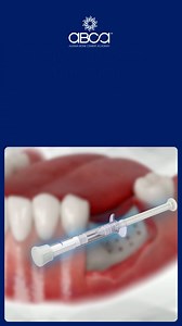 Can I use Augma for Immediate Implant Placement?