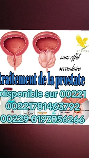 Vidéos de Thibault (@thibault3306) avec son original - santé naturelle