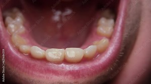 Close up of slightly yellowish unclean front bottom teeth while wide open mouth.